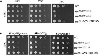 The Glycerol Phosphatase Gpp2: A Link to Osmotic Stress, Sulfur Assimilation and Virulence in Cryptococcus neoformans